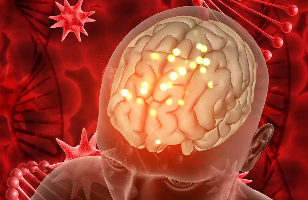 Brain Tumor